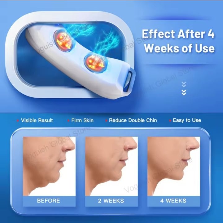 Pure Elegance | EMS V Face Beauty Device Vibration Face Massager Lifter Electric V-Line Face Lifting Belt Removing Double Chin Up Face Shaper
